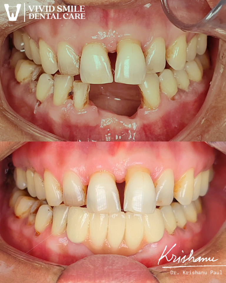 Untitled-1-Krishanu (3)