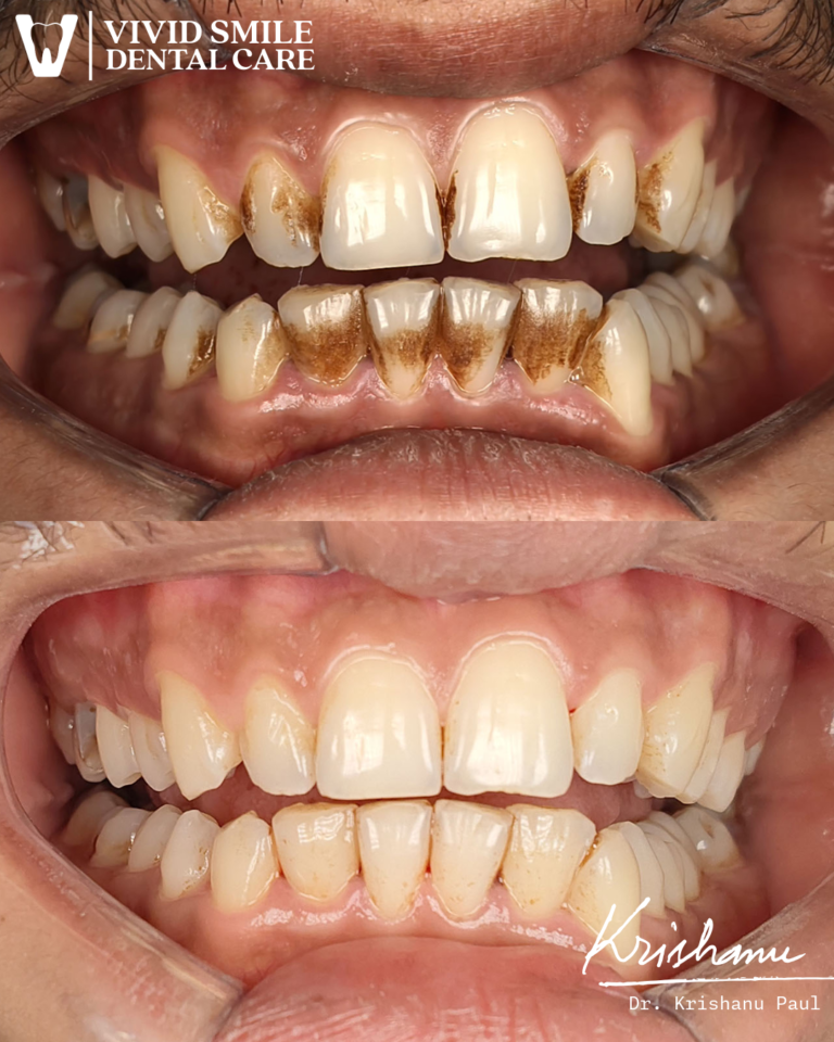 Untitled-2-Krishanu (2)