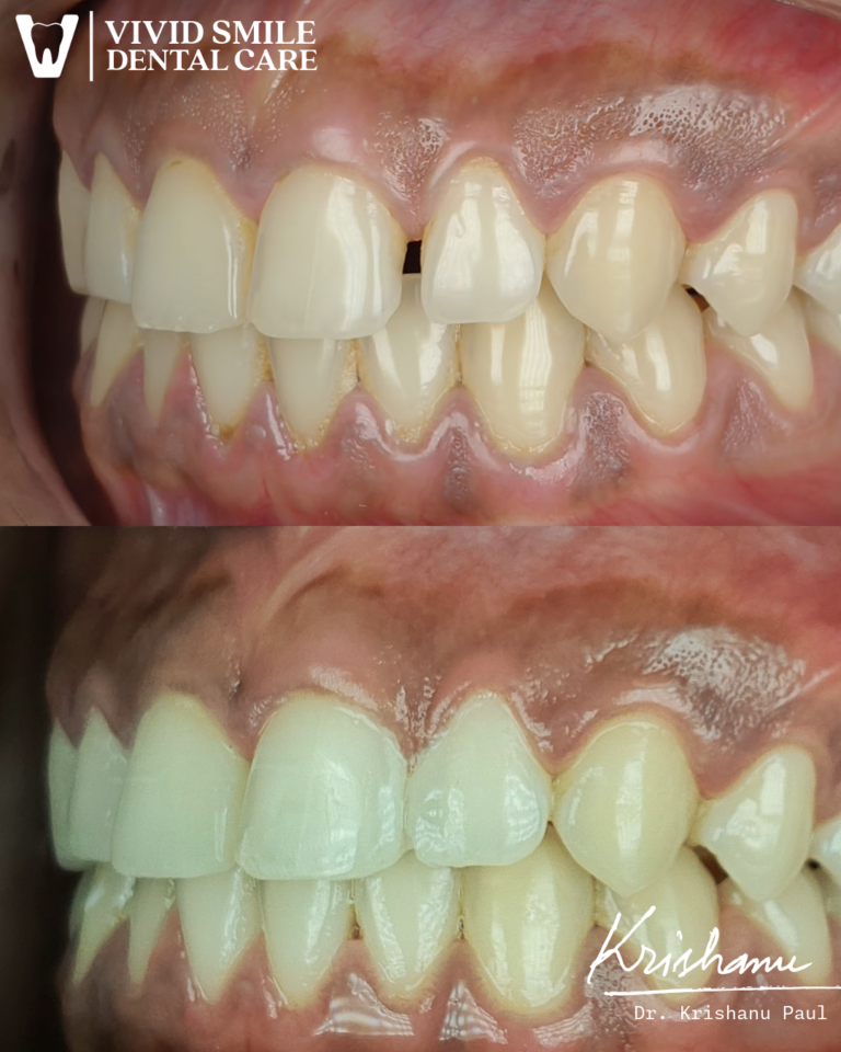 Untitled-2-Krishanu (3)