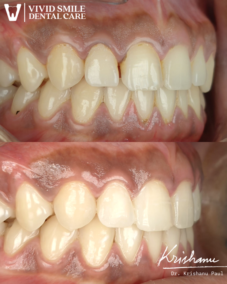 Untitled-2-Krishanu (4)