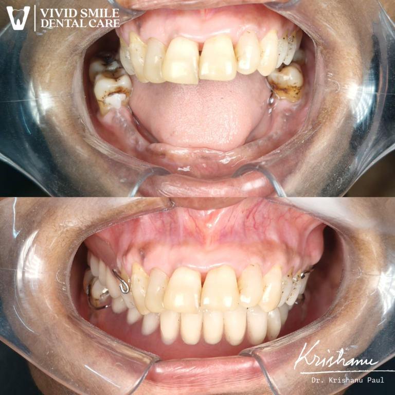 Untitled-3-Krishanu (1) (1)